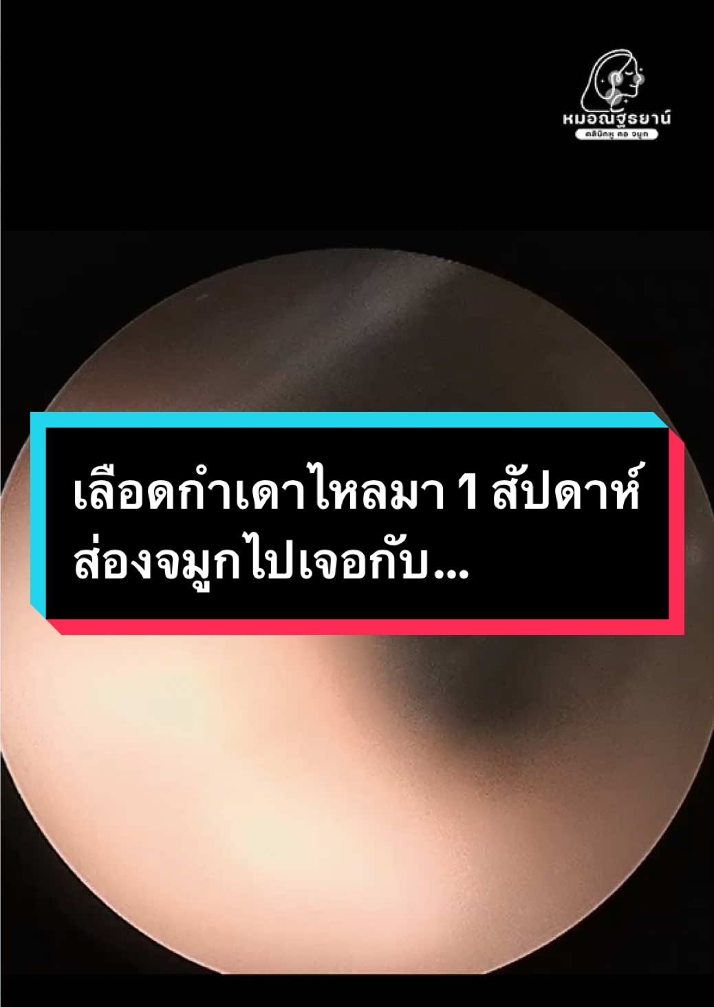 @คลินิกหมอณัฐธยาน์ หู คอ จมูก
