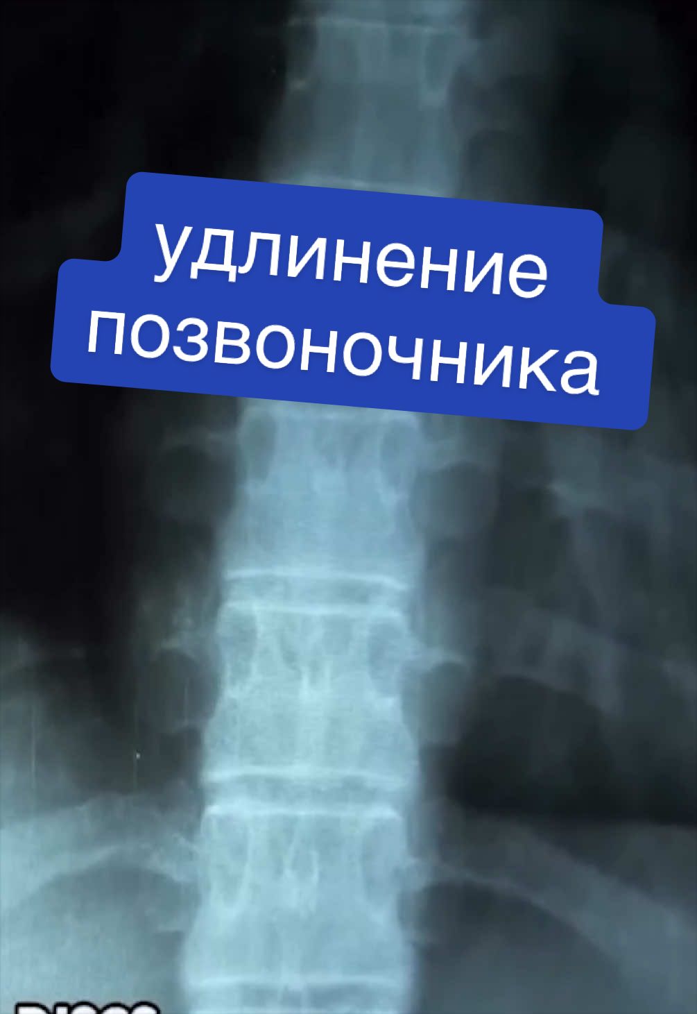 @Повыше к Небесам