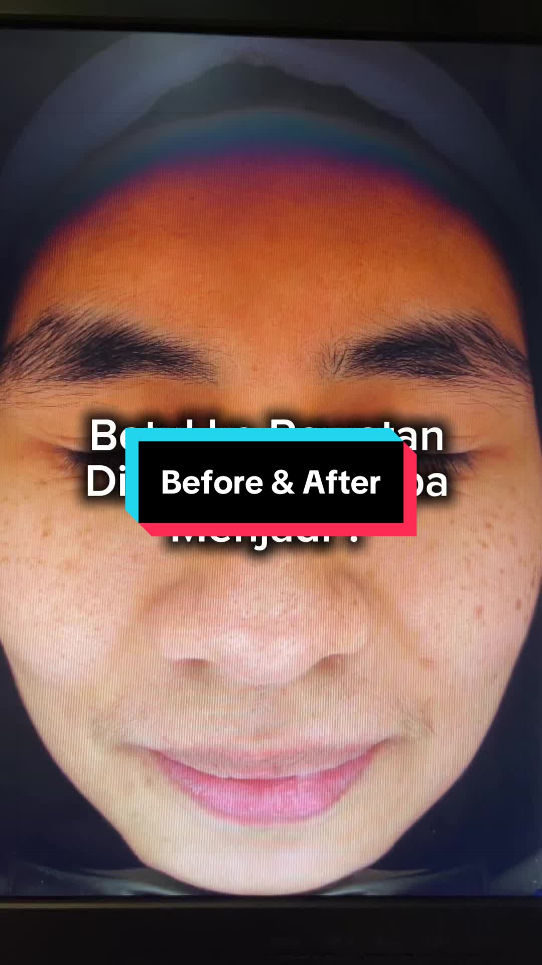 @Beylla Medispa Sandakan