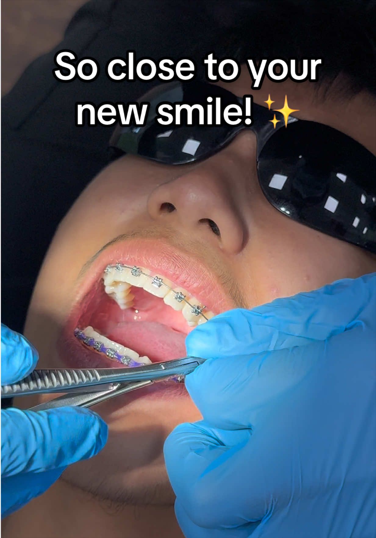 @Pure Orthodontics