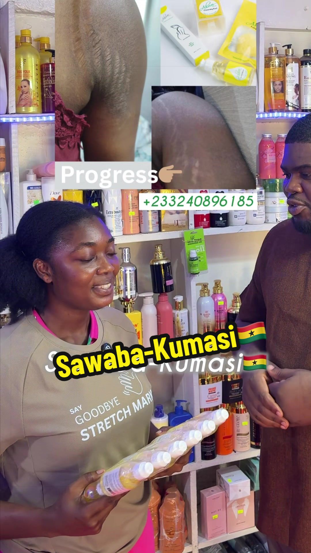 @No1 STRETCH MARKS PRODUCT