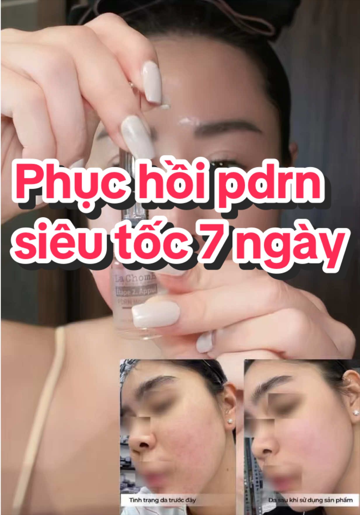 @Hồng Nhung nun