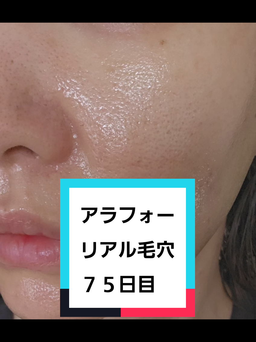 @リアル毛穴改善記録