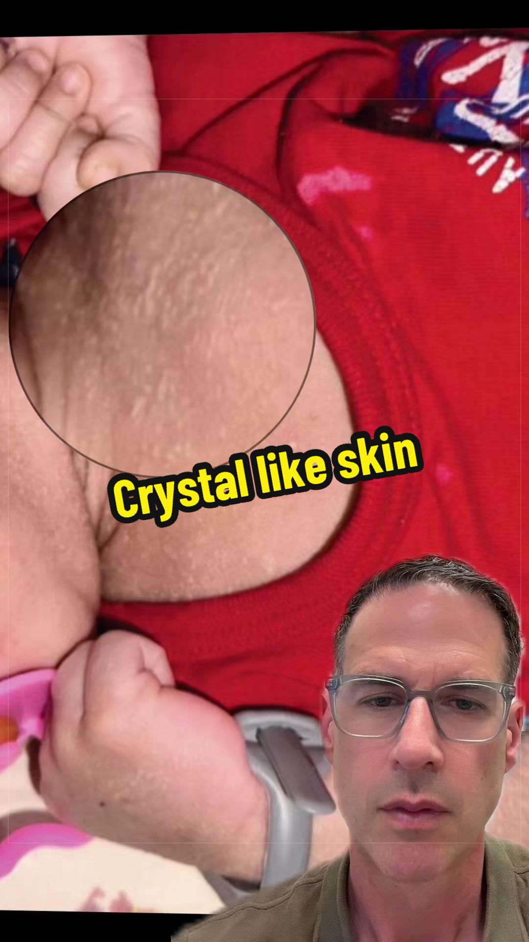 @Dr Michael Narvey 🇨🇦