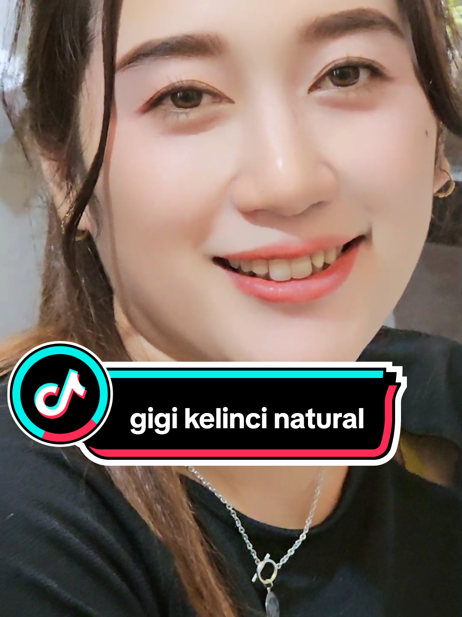 @Fiqygigi