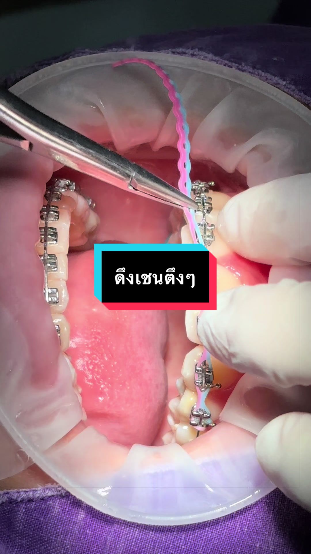 @ซอฟแอนด์สไมล์ลาดกระบัง