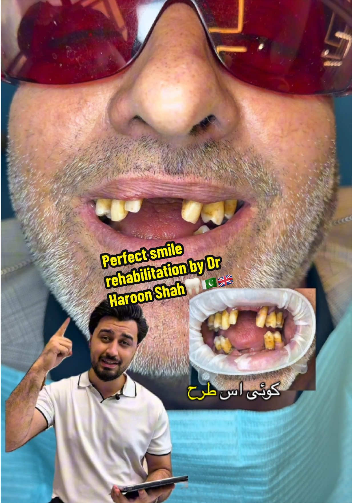 @Dr Haroon Shah