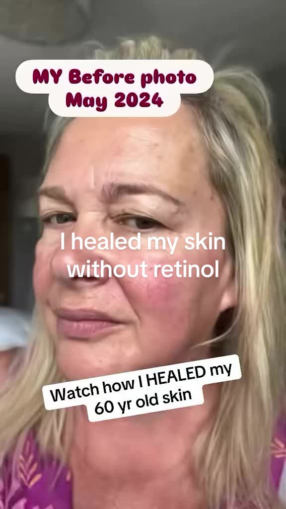 @Lookingyoungerwithchristine