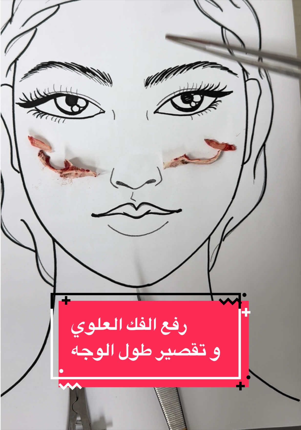 @Dr.Faleh Ali Alshahrani