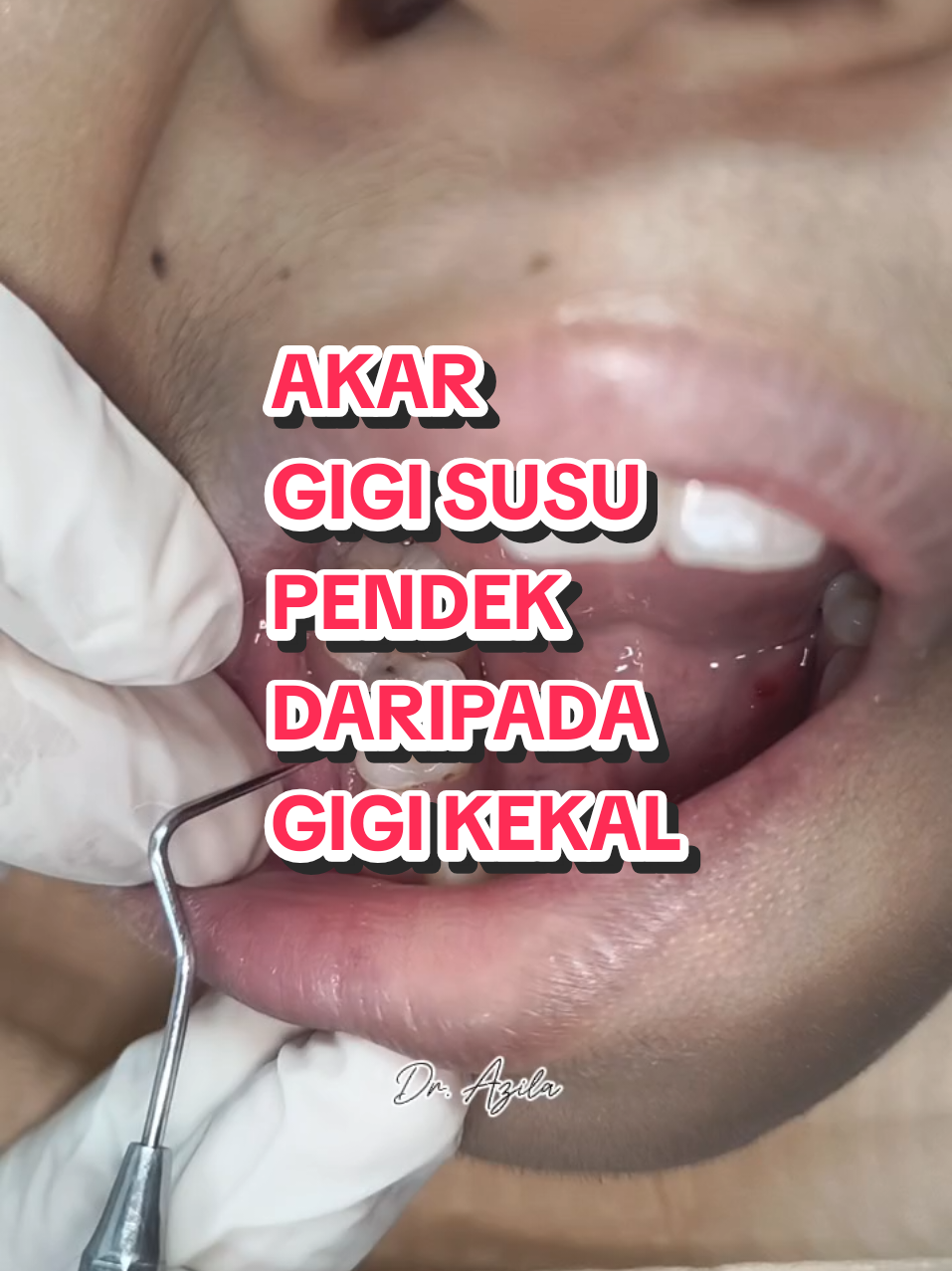 @Dr. Azila
