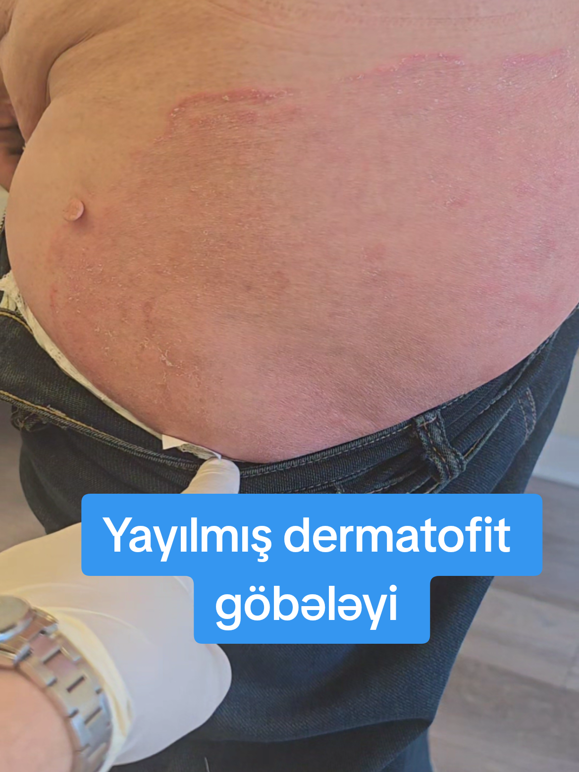 @Dr.Eldar Məmmədov