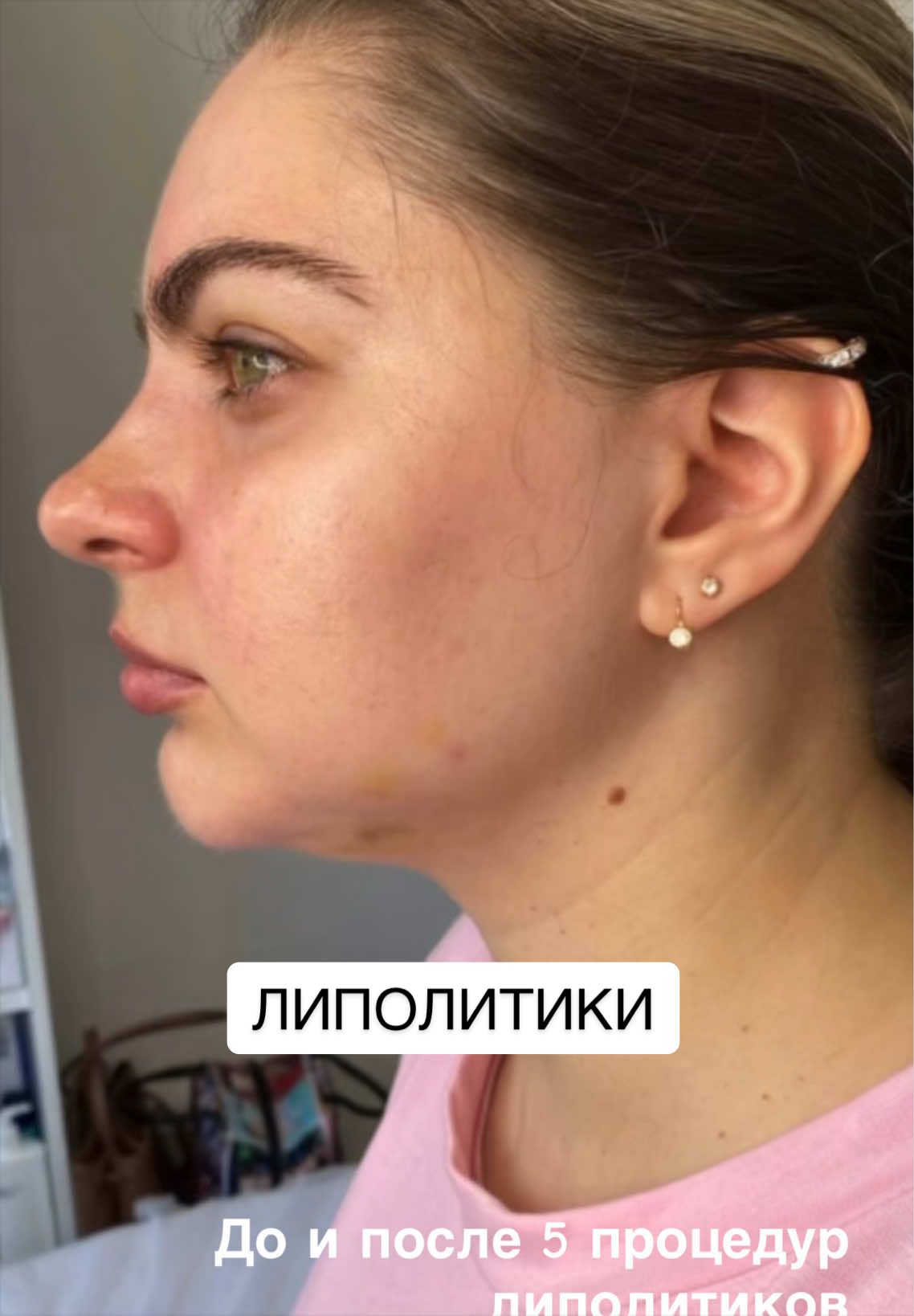 @dr.anush.cosmetolog