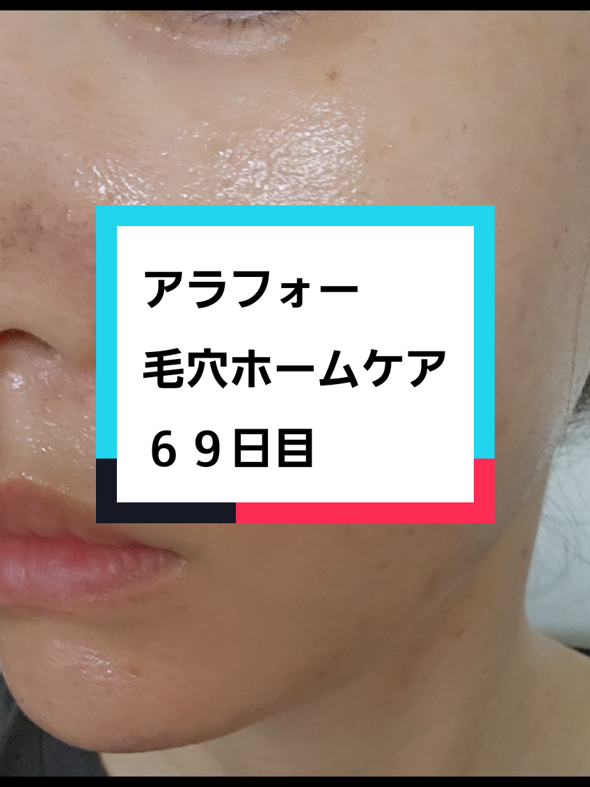 @リアル毛穴改善記録