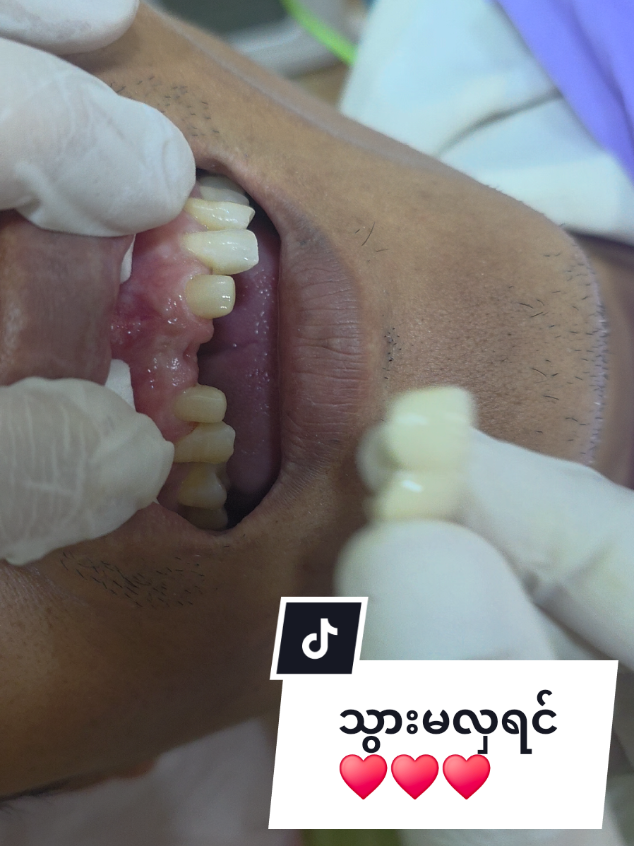 @Dr.KoKoSawMin(သွားဆရာဝန်)