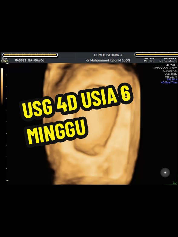 @USG 4D PURWOKERTO