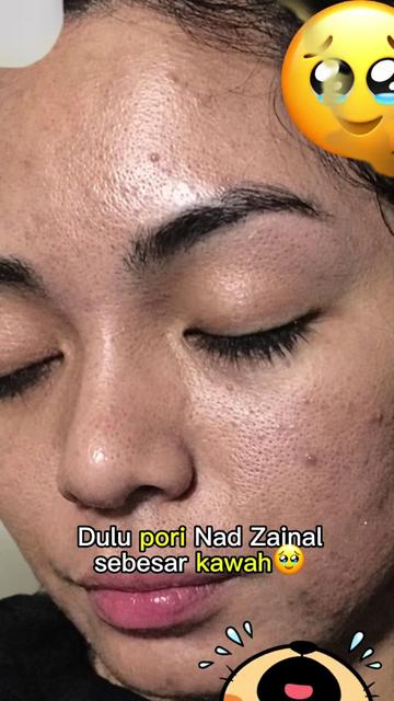 @SKINELLE