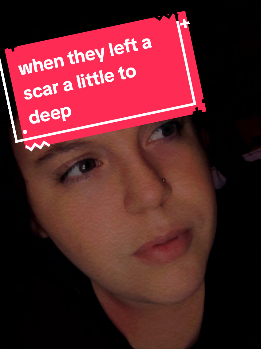 @Jess