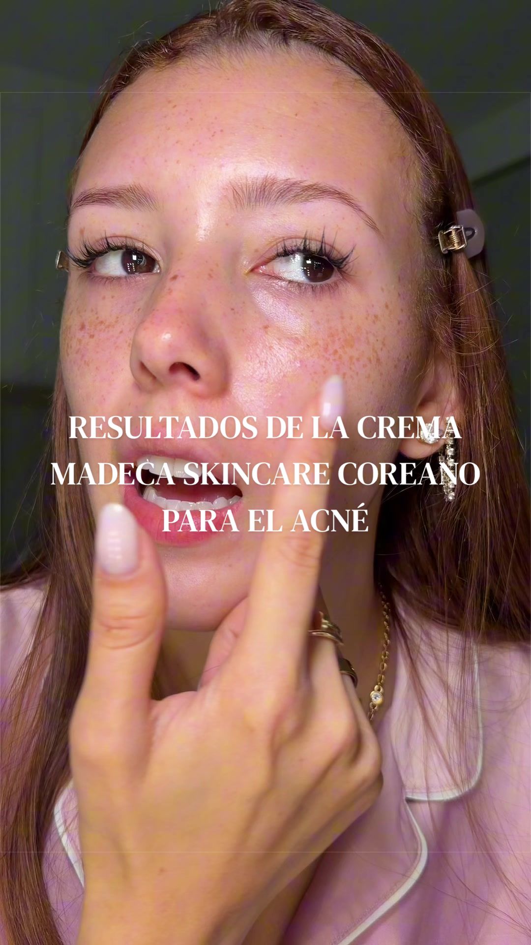 @Andrea Escorcia