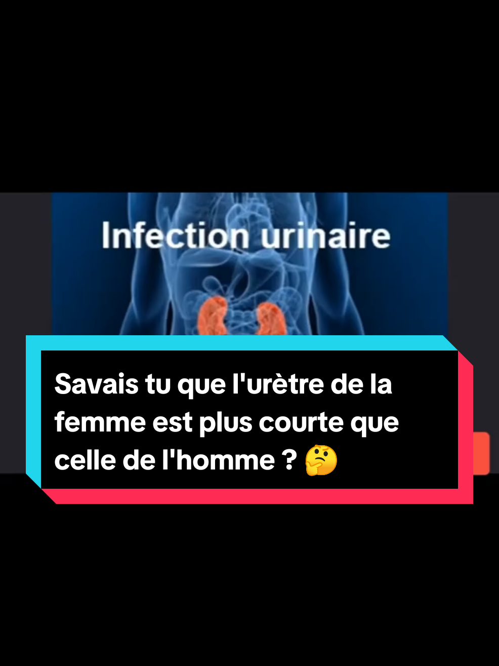 @Dr Ted