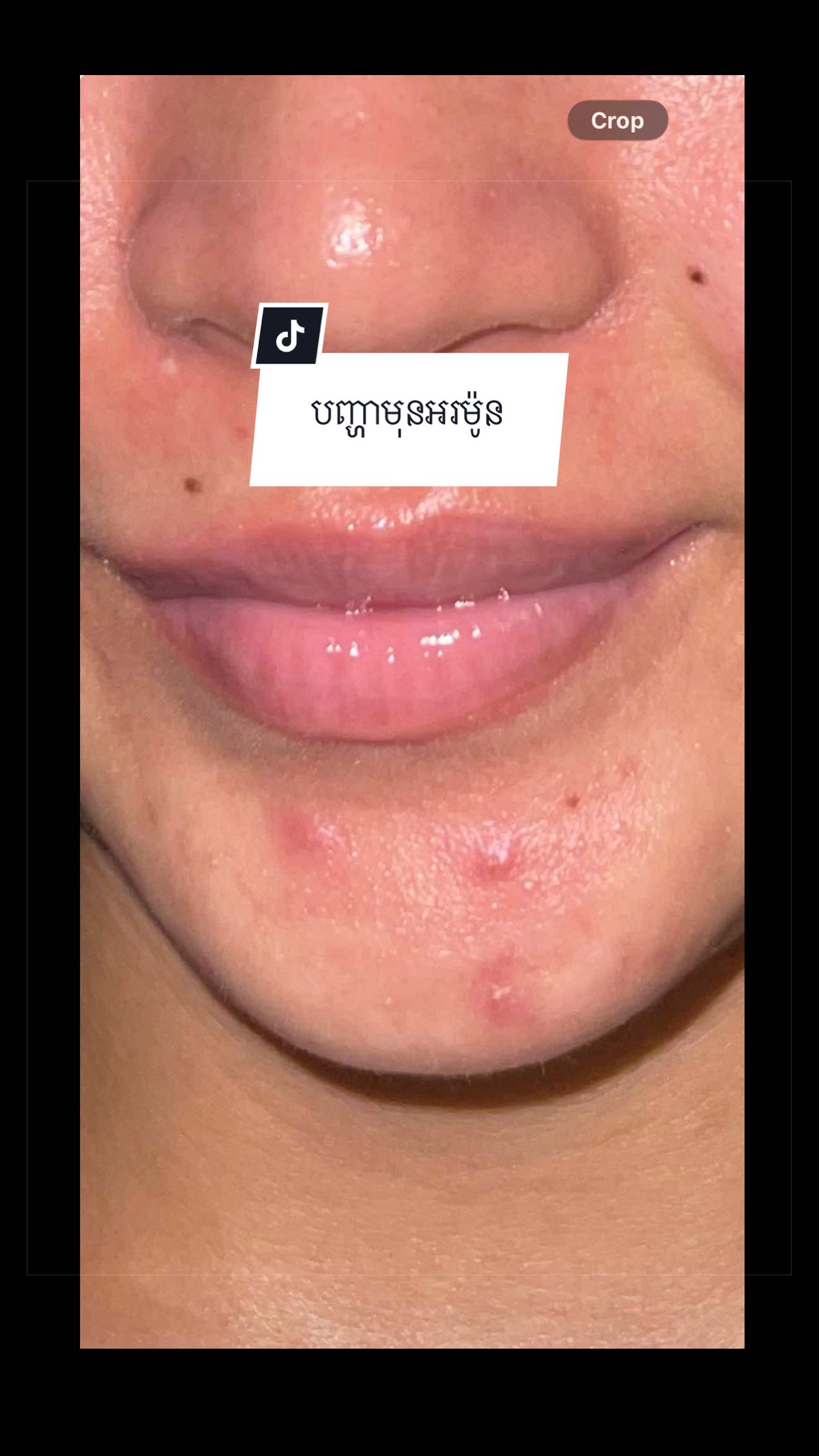 @BetterSkin
