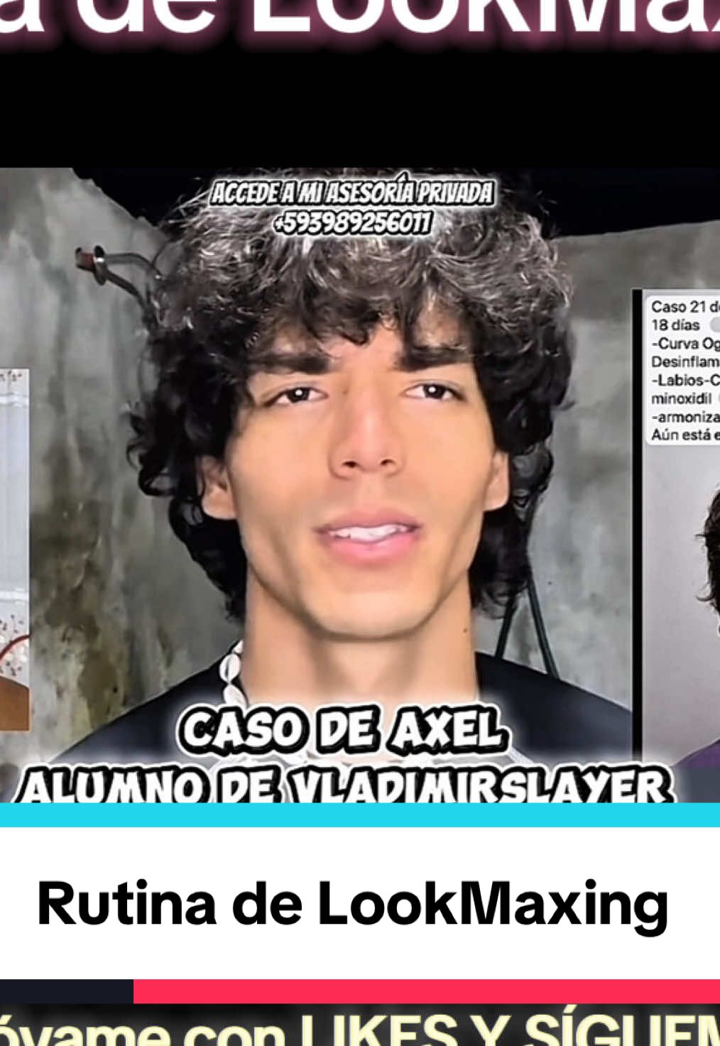 @vladimirslayer