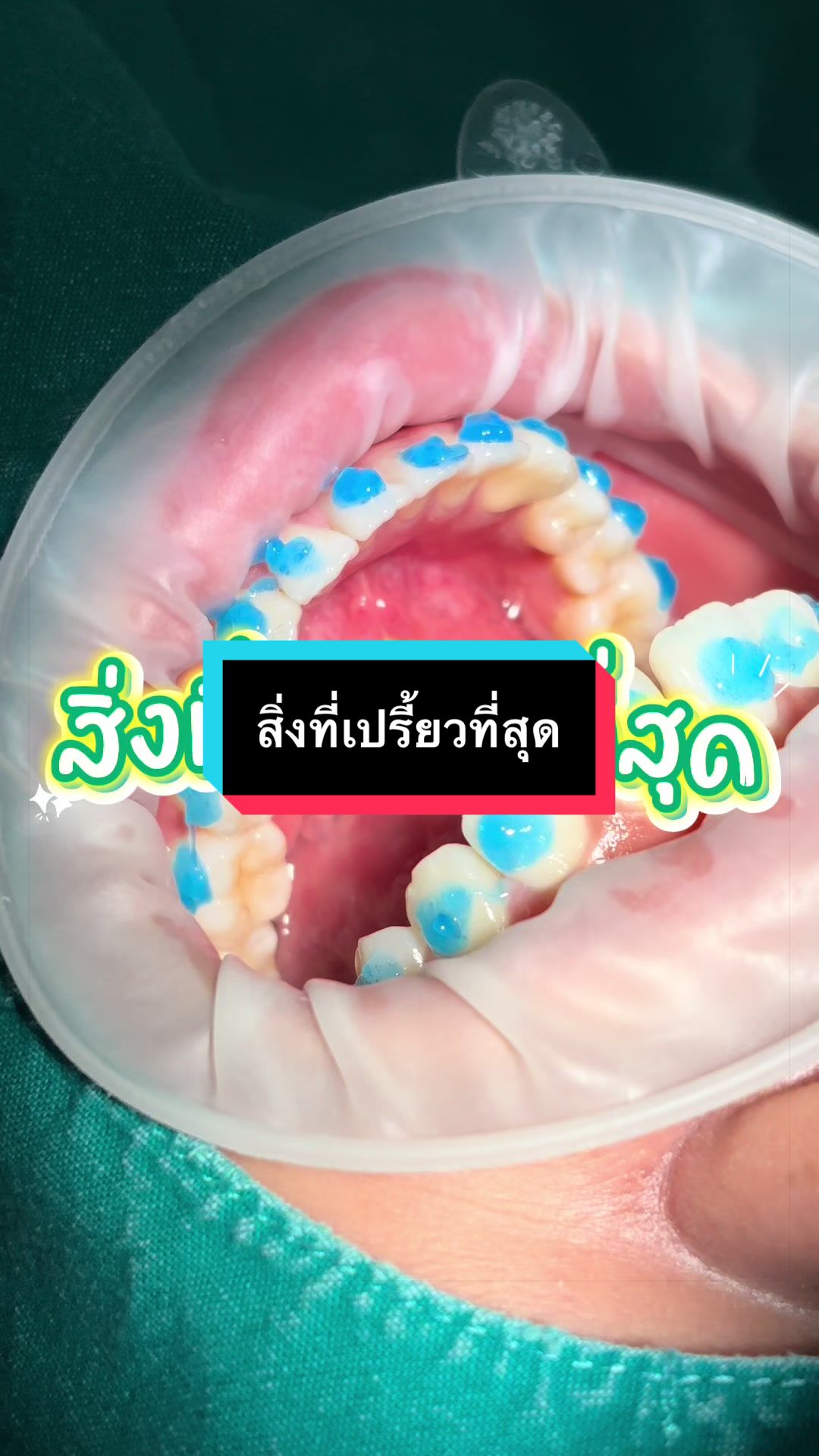 @ซอฟแอนด์สไมล์ลาดกระบัง