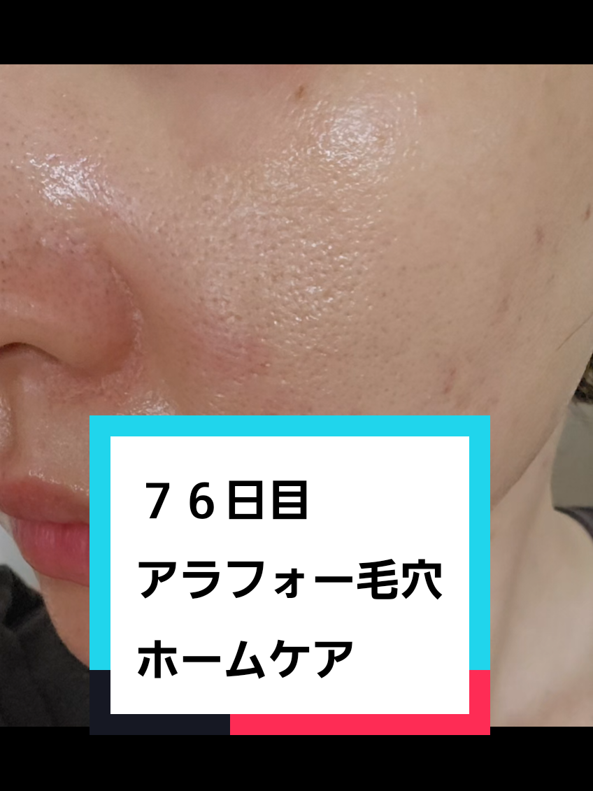@リアル毛穴改善記録