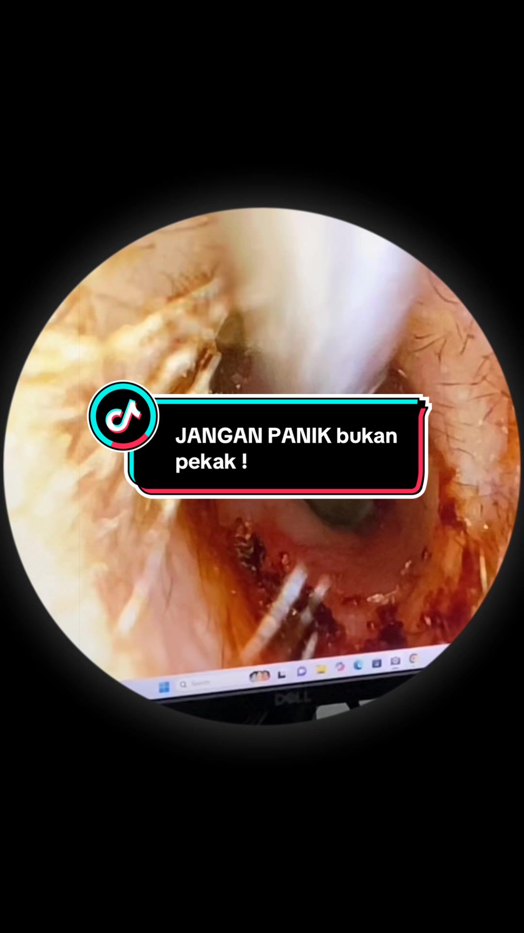 @Klinik Aqwa Care
