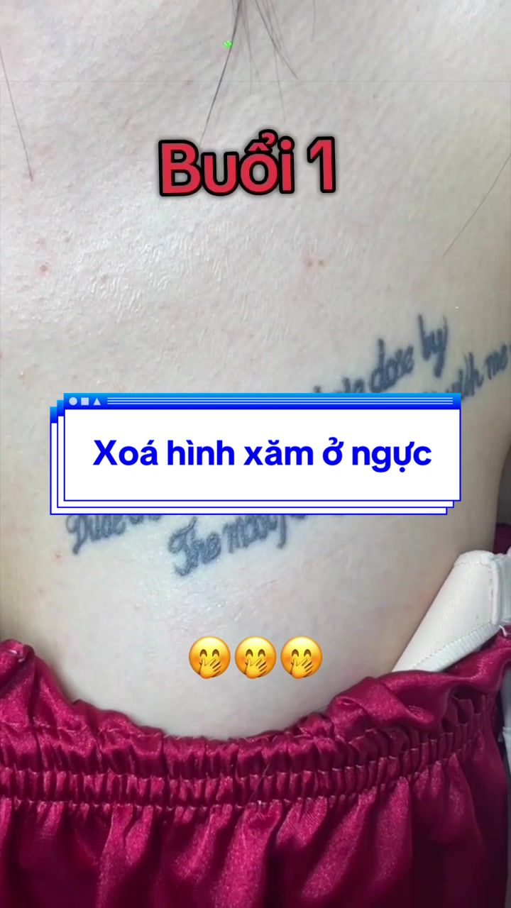 @Xo&aacute; xăm k sẹo H&agrave; Nội💧