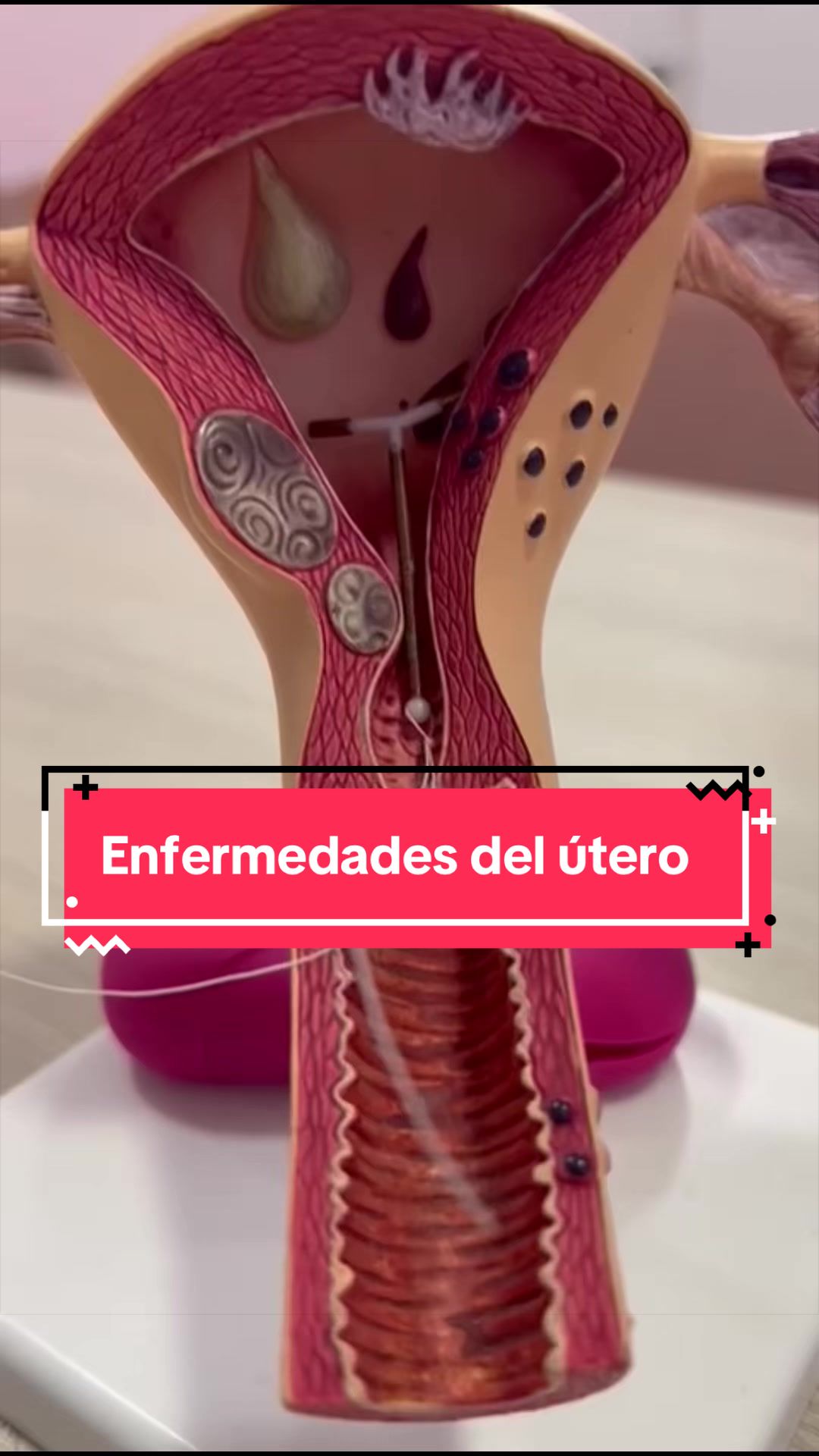 @Dra. Verónica Reyes Ginecóloga