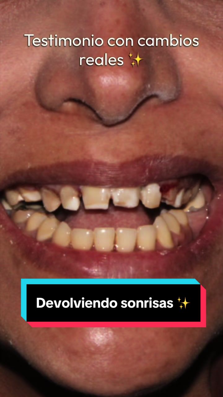 @GabeApreza