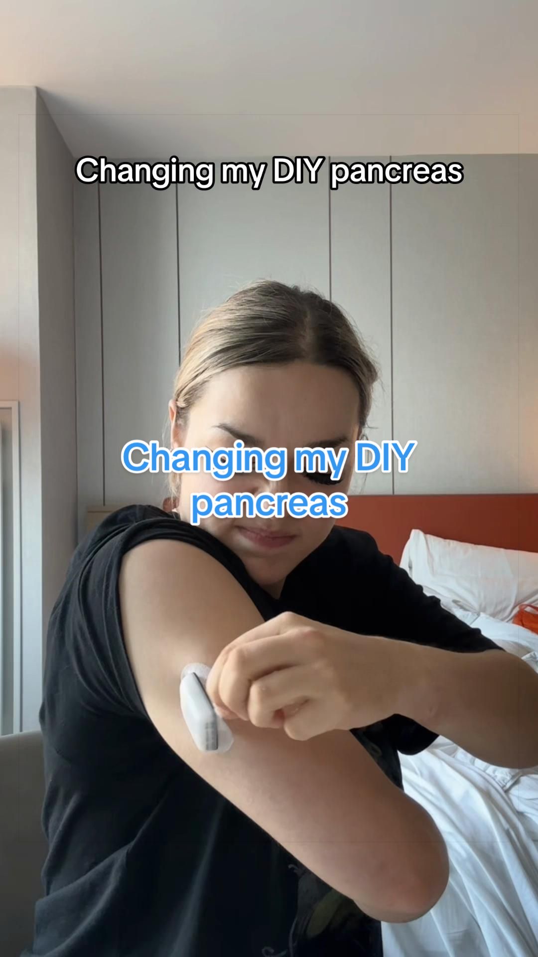 @TYPE 1 DEEABETES