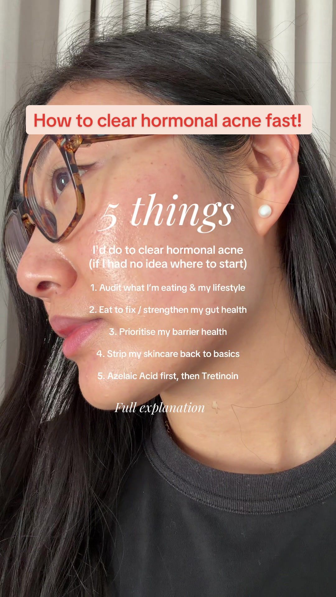 @Lisa | acne → clear skin