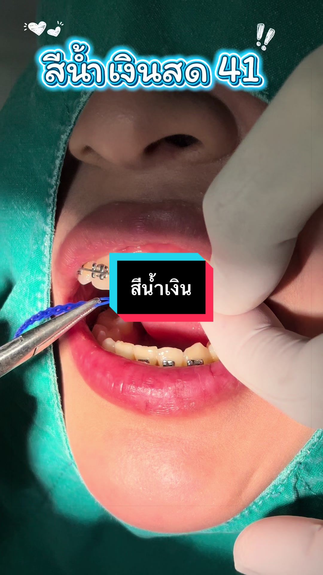@ซอฟแอนด์สไมล์ลาดกระบัง