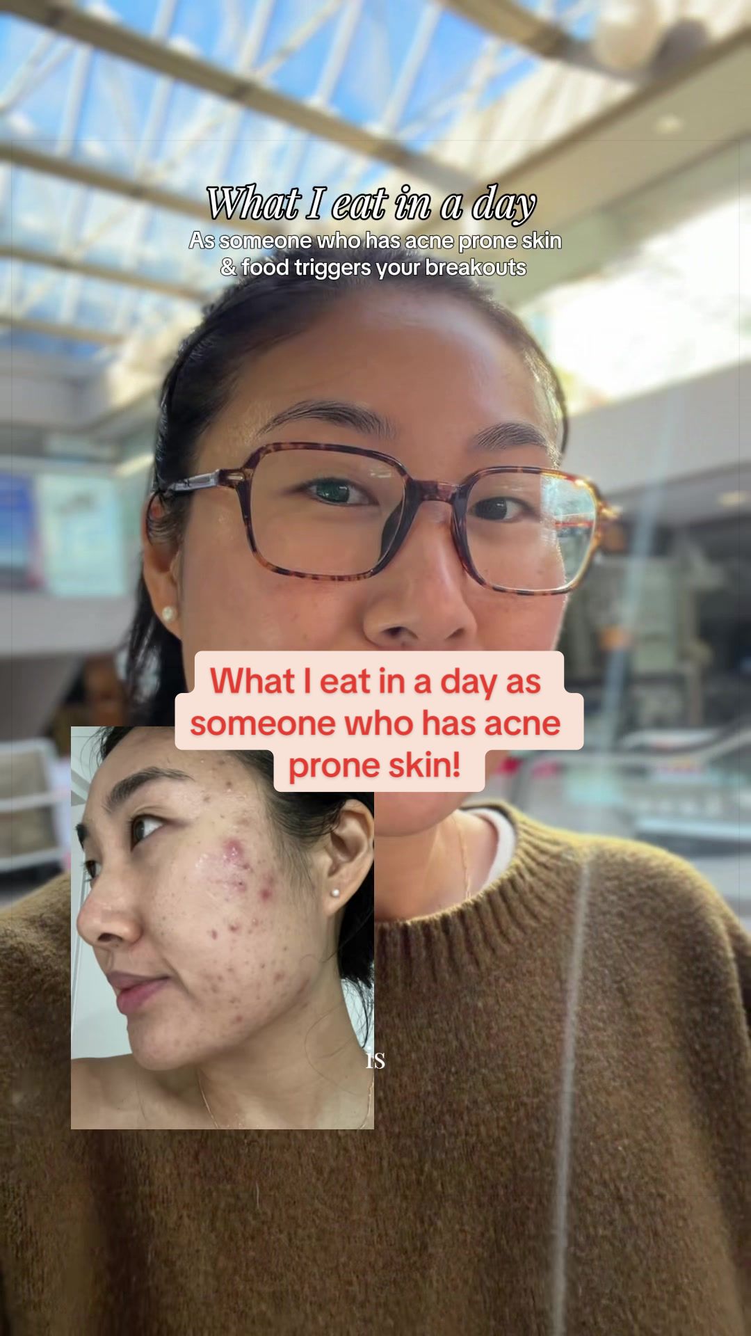 @Lisa | acne → clear skin
