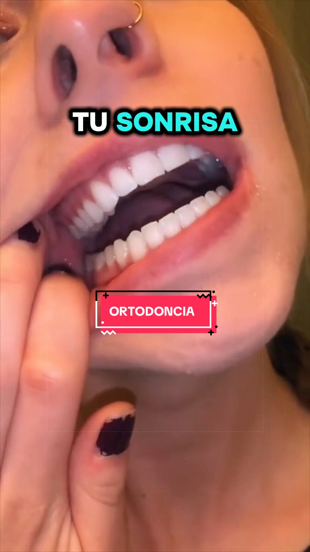 @Dr Carillas