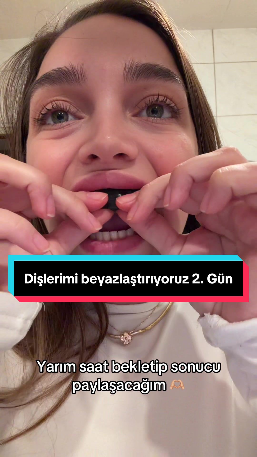 @RABİA