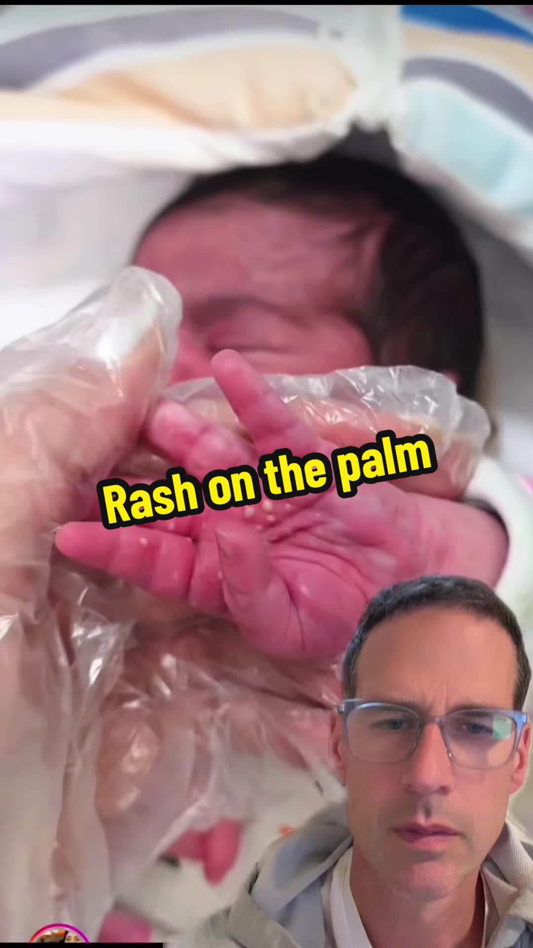 @Dr Michael Narvey 🇨🇦