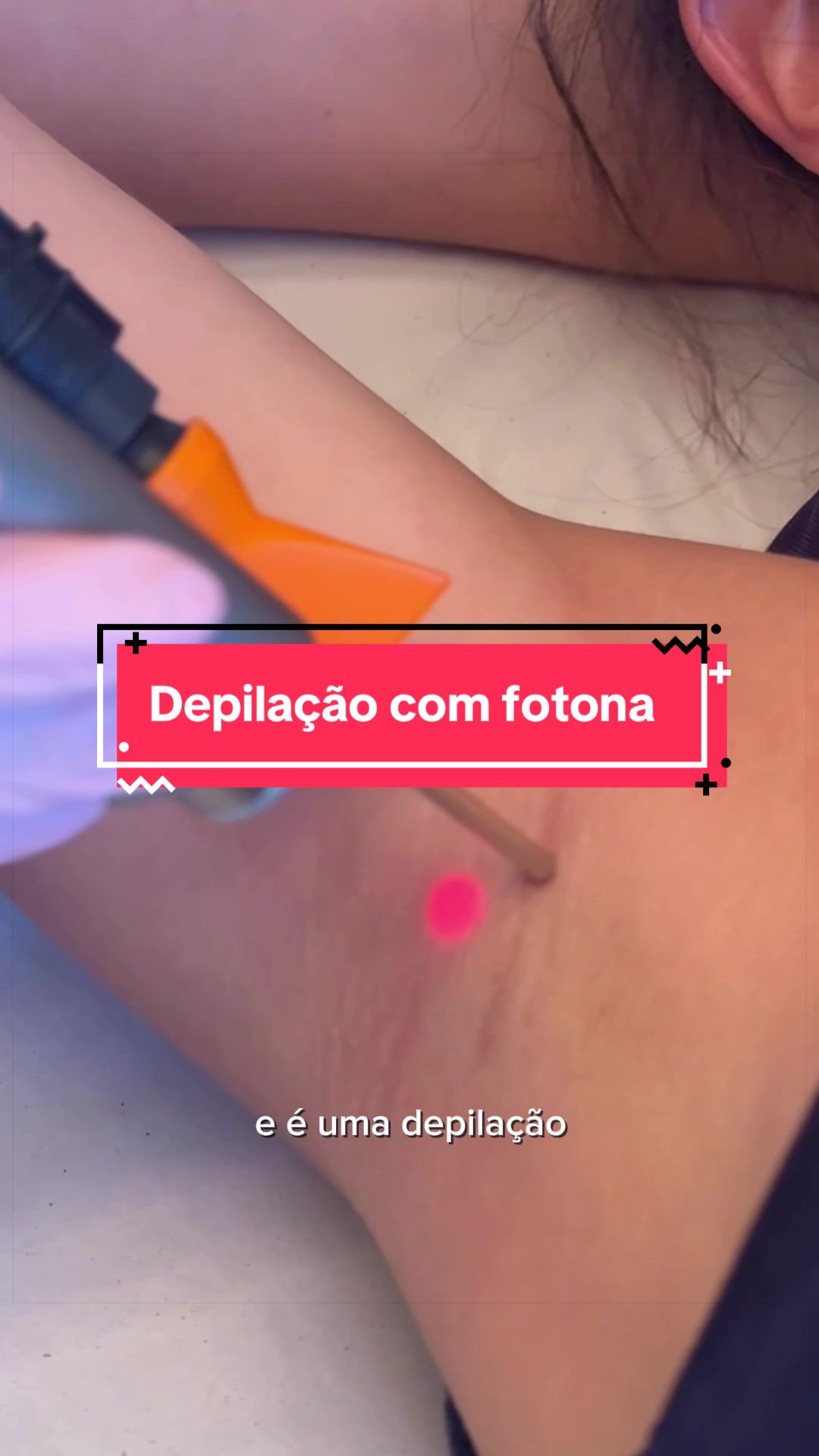 @Lays de Alcântara | Dermato