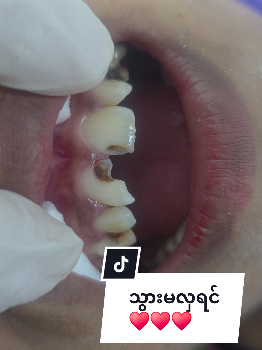 @Dr.KoKoSawMin(သွားဆရာဝန်)