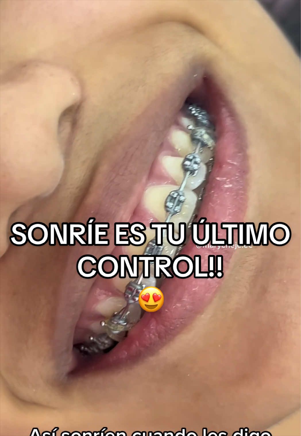 @Od. Marilyn Chejade L. 😷🦷