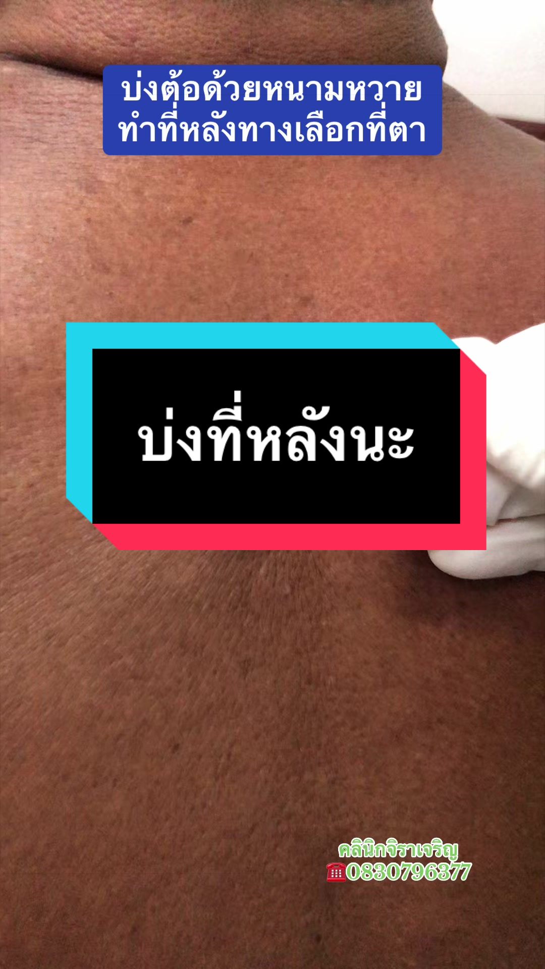 @หมอเชอร์รี่