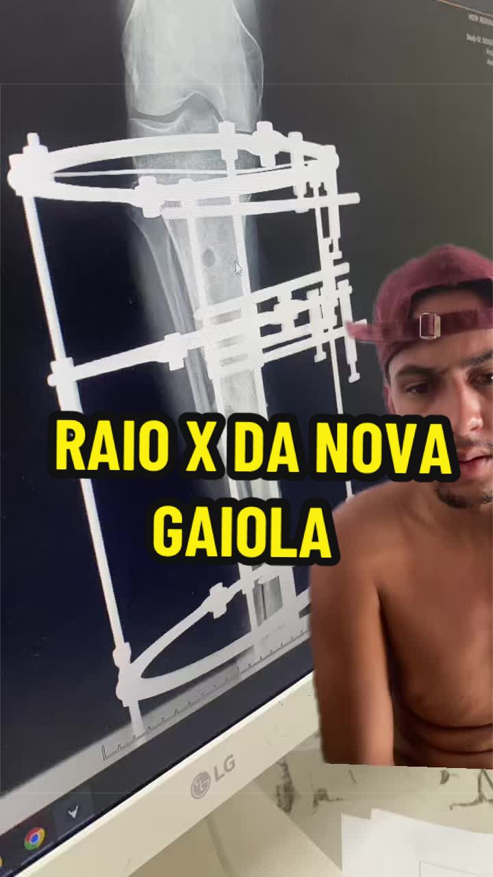 @Halef Henrique