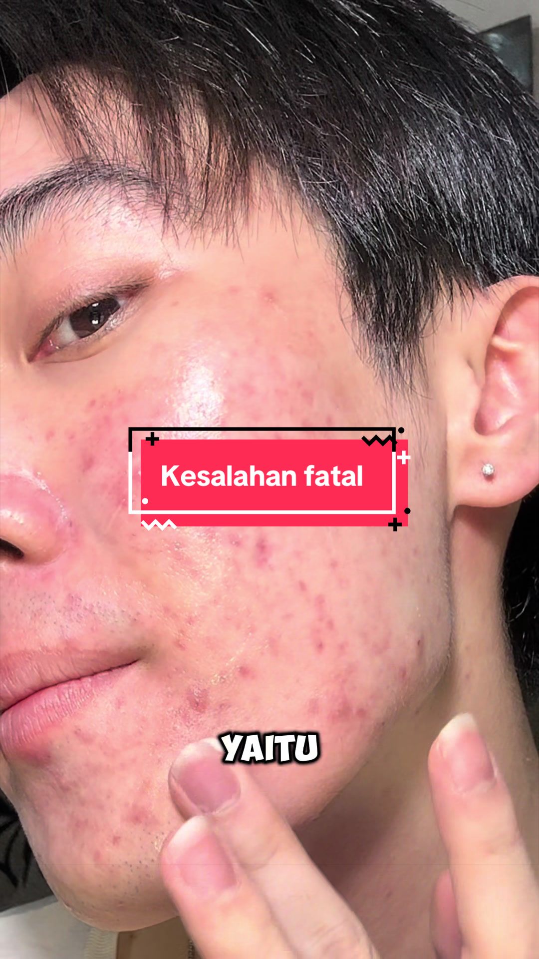 @Mau kulit sehat