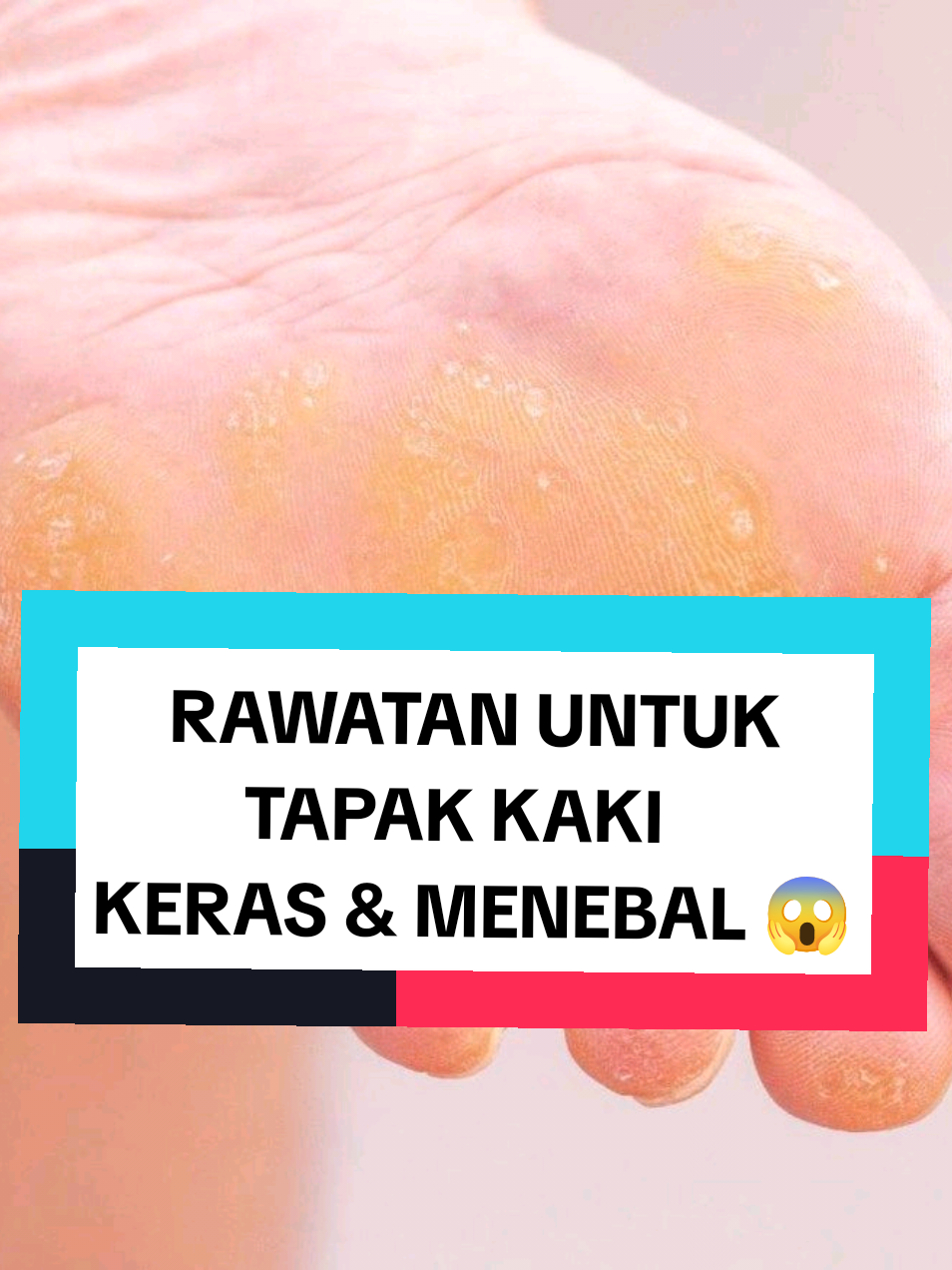 @Rawatan Kulit,Echo,Antenatal