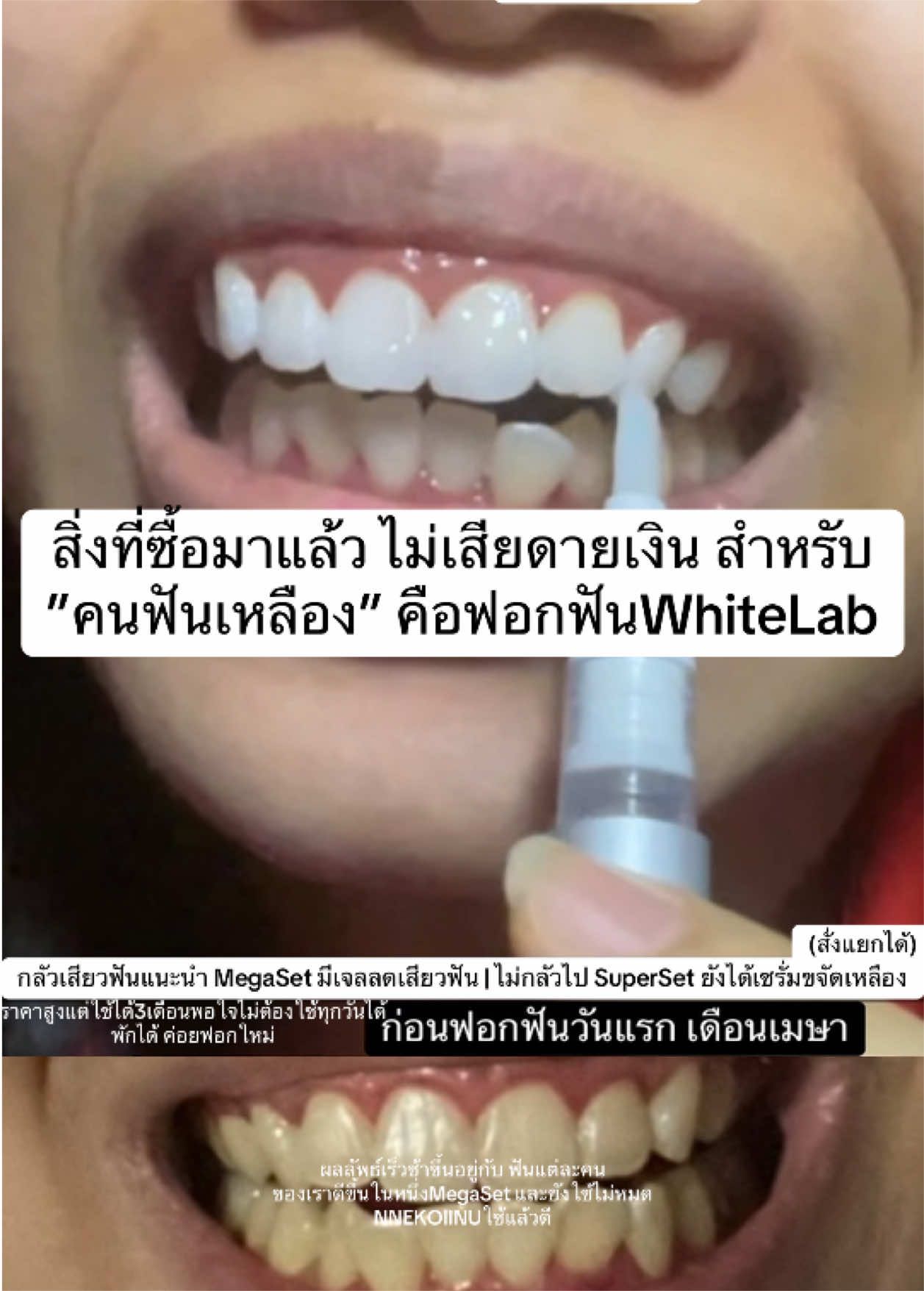 @NNEkOIINUใช้แล้วดี