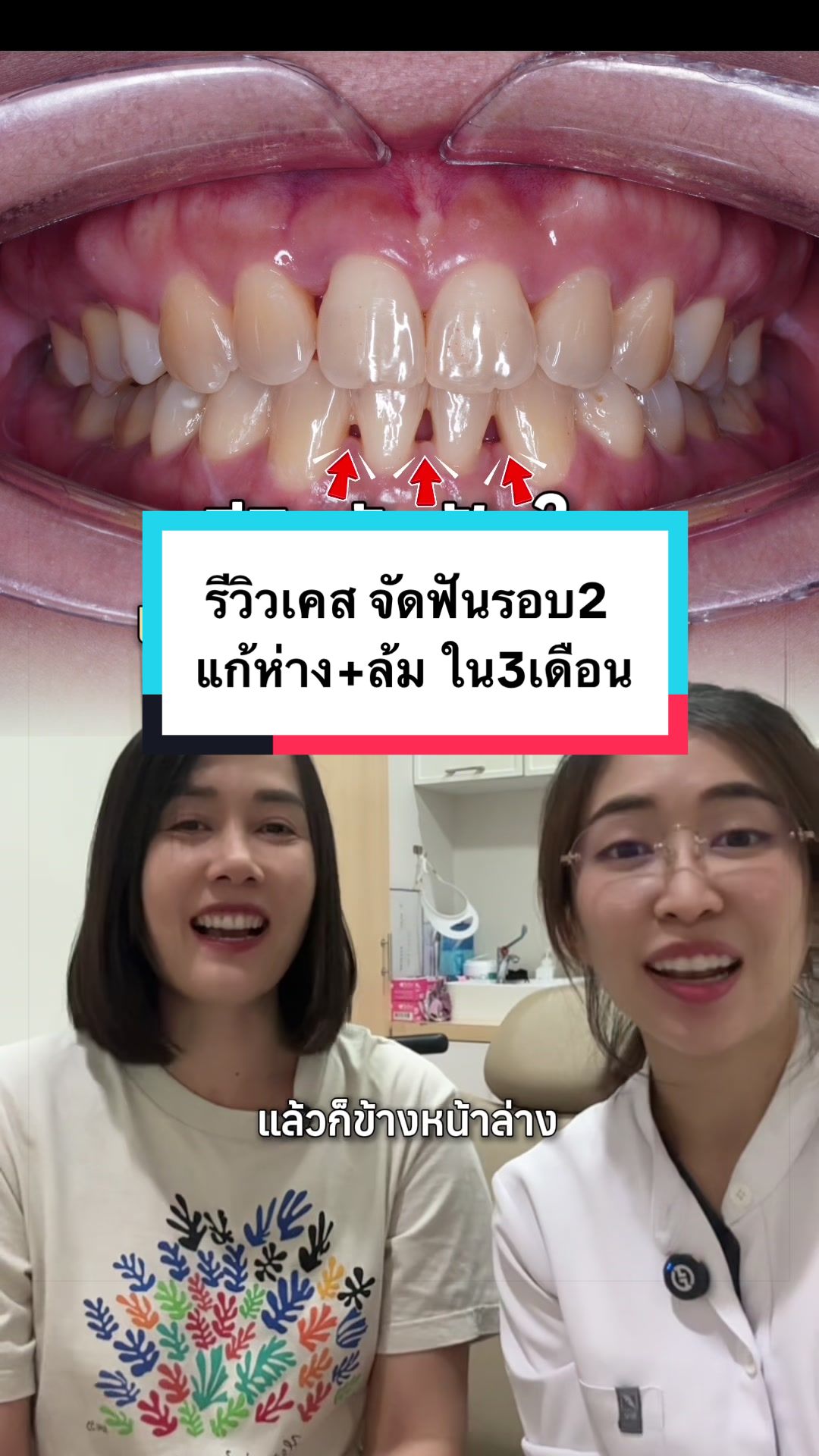 @ณัฐคุณ (Nuttakul Dent) 🦷
