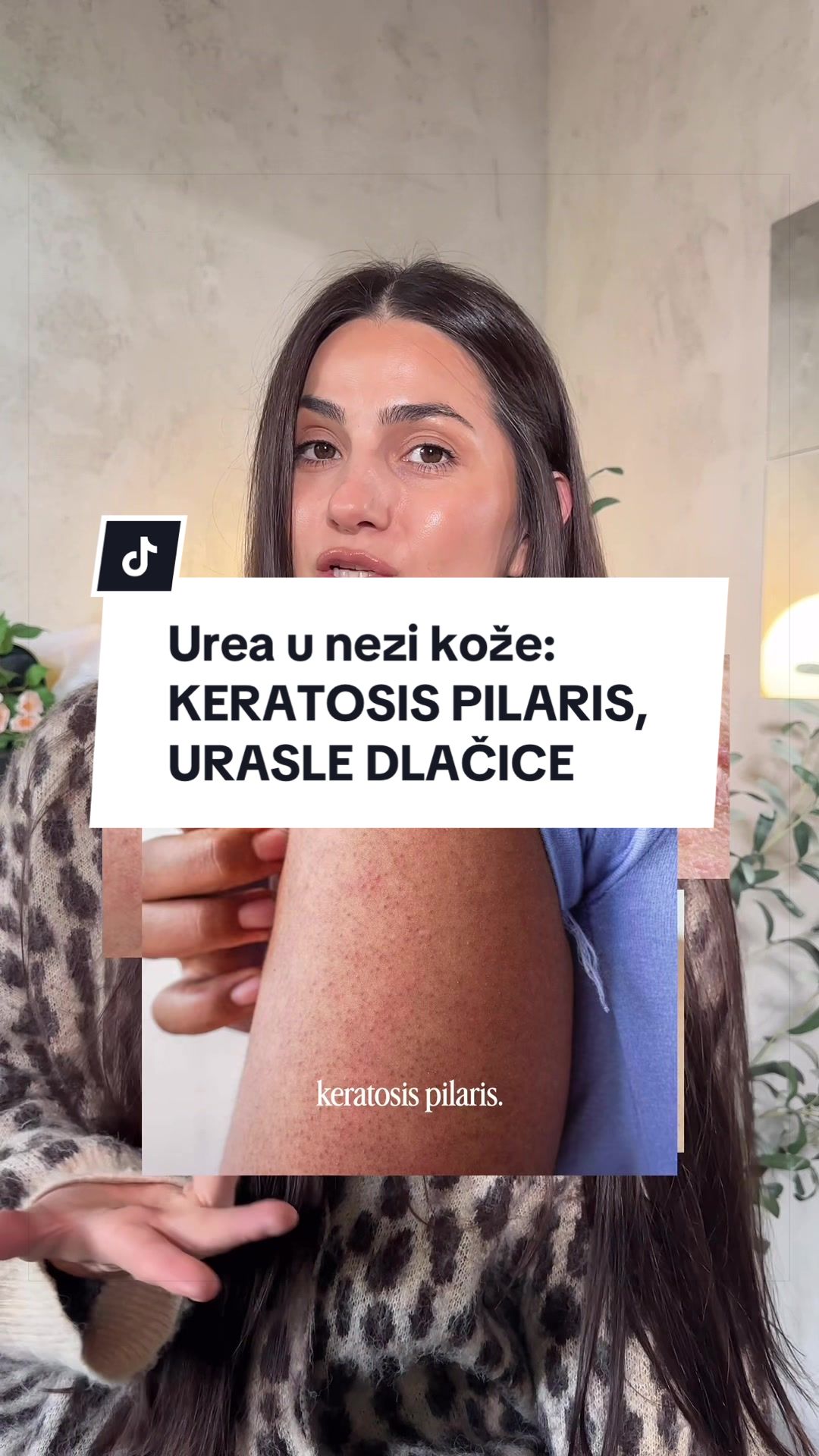 @biosskin