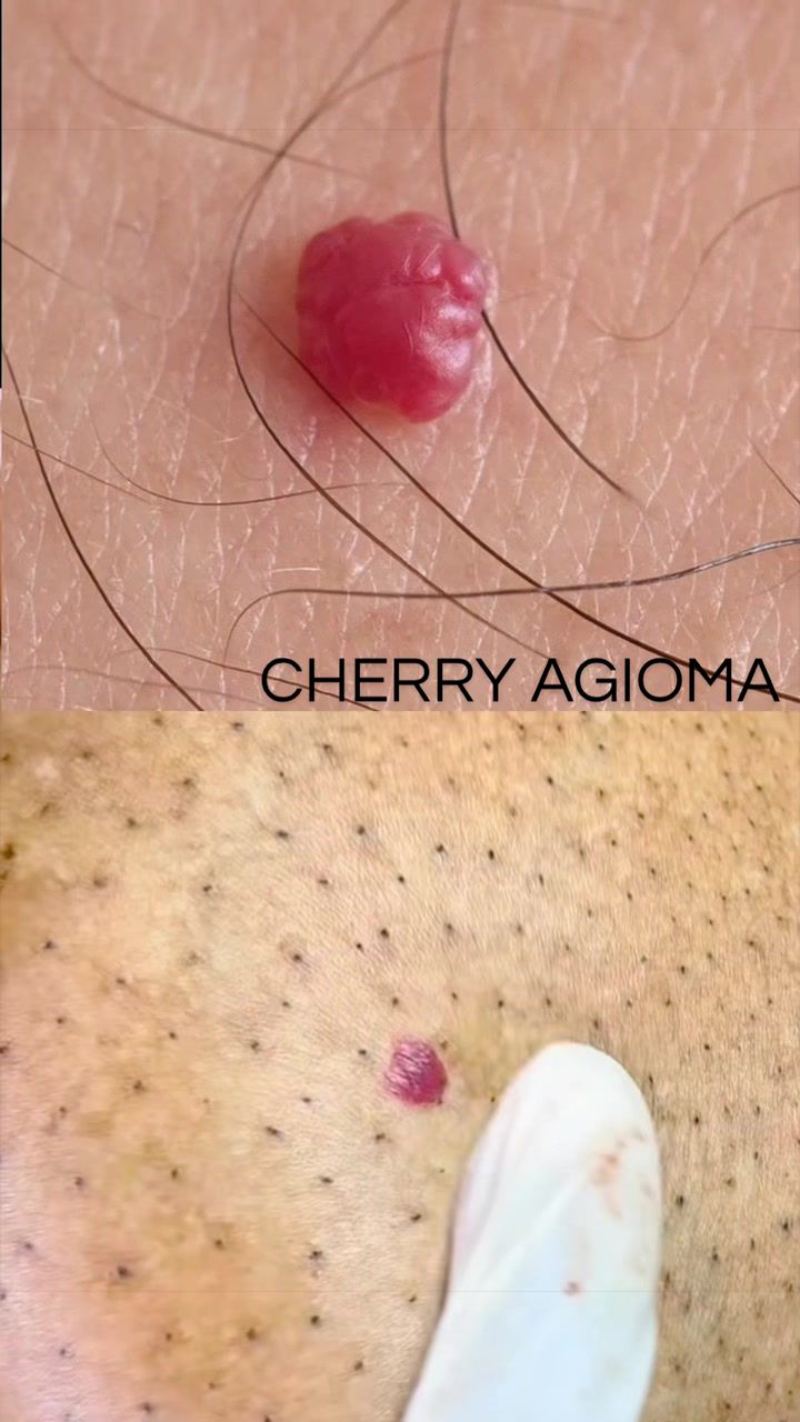 @Skin Dictionary
