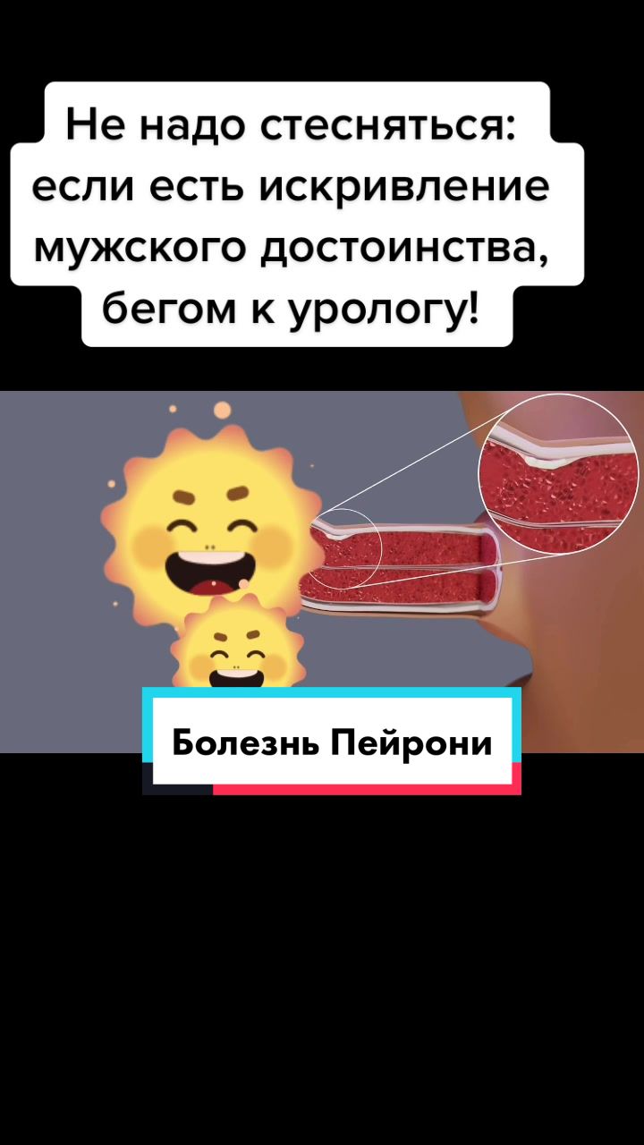 @Denis Davydov